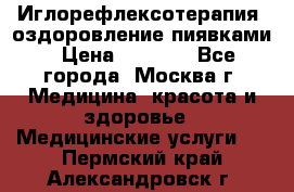 Иглорефлексотерапия, оздоровление пиявками › Цена ­ 3 000 - Все города, Москва г. Медицина, красота и здоровье » Медицинские услуги   . Пермский край,Александровск г.